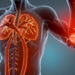 Inflammation Home Remedies Symptoms, Causes, Prevention and Cure