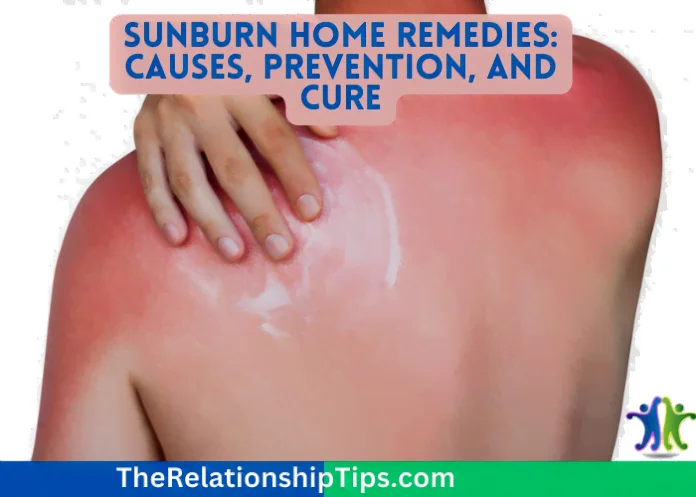 Sunburn Home Remedies: Causes, Prevention, and Cure