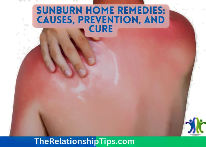 Sunburn Home Remedies: Causes, Prevention, and Cure Sunburn Home Remedies: Causes, Prevention, and Cure