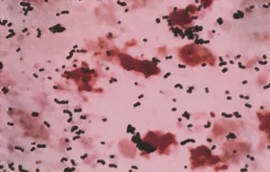 5 Ways to Prevent Group B Streptococcus (GBS) from Affecting Your Baby During Pregnancy