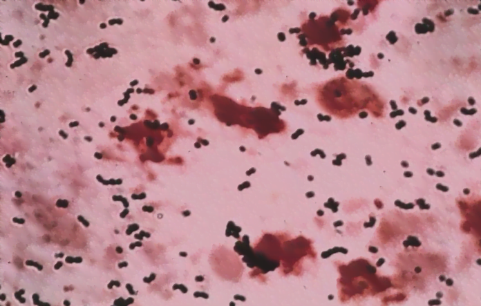 5 Ways to Prevent Group B Streptococcus (GBS) from Affecting Your Baby During Pregnancy
