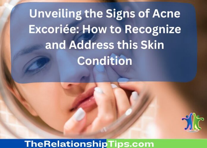 Unveiling the Signs of Acne Excoriée: How to Recognize and Address this Skin Condition