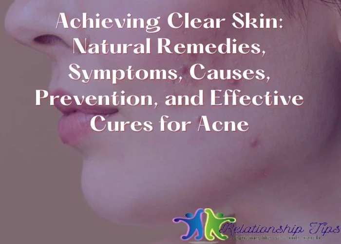 Achieving Clear Skin - Natural Remedies, Symptoms, Causes, Prevention, and Effective Cures for Acne Achieving Clear Skin: Natural Remedies, Symptoms, Causes, Prevention, and Effective Cures for Acne