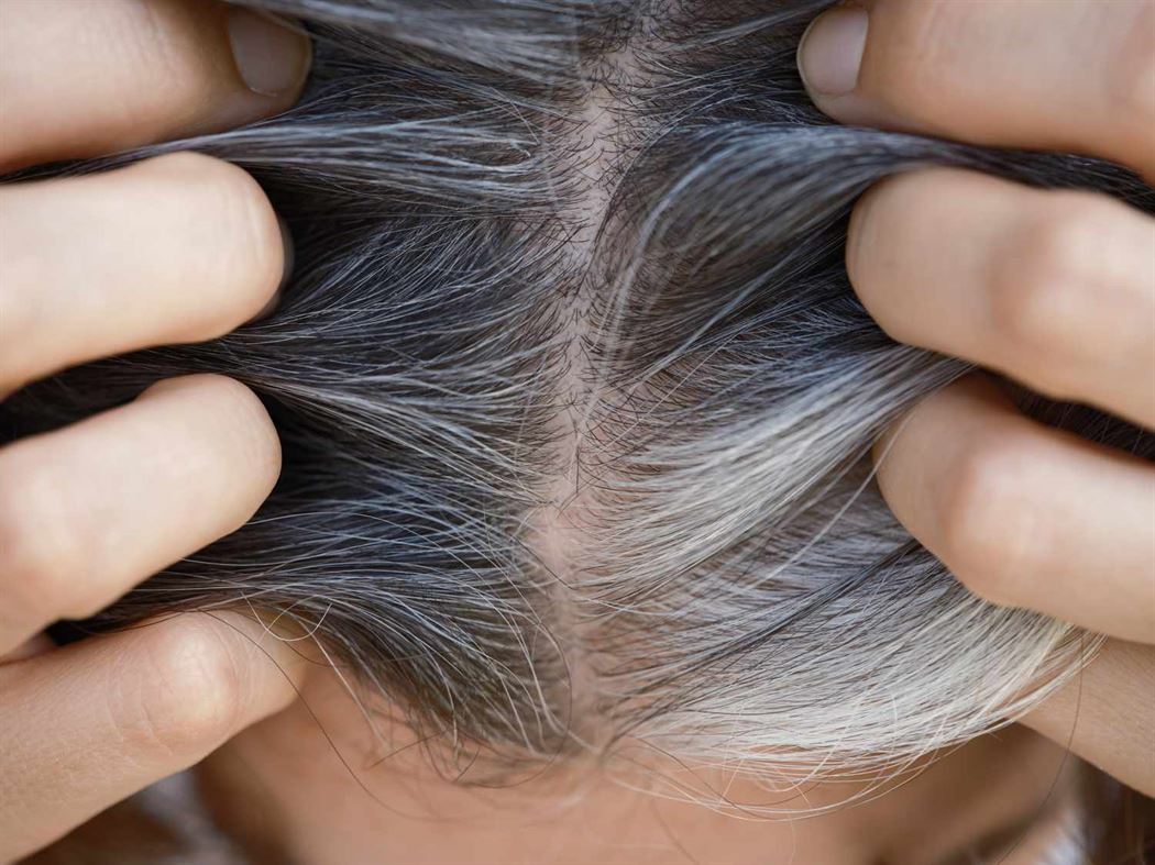 Preventing Premature Grey Hair: 10 Lifestyle Fixes