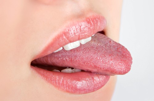 Decoding Tongue Color: What It Reveals About Your Health